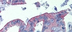 Invitrogen CGI58 Polyclonal Antibody 100 &mu;L; Unconjugated:Antibodies,