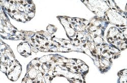 Invitrogen SLC48A1 Polyclonal Antibody 100 &mu;L; Unconjugated:Antibodies,