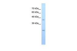 Invitrogen SLC48A1 Polyclonal Antibody 100 &mu;L; Unconjugated:Antibodies,