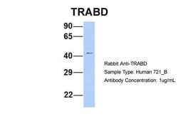 Invitrogen TRABD Polyclonal Antibody 100 &mu;L; Unconjugated:Antibodies,