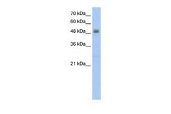 Invitrogen Viperin Polyclonal Antibody 100 &mu;L | Buy Online | Invitrogen&trade; | Fisher Scientific