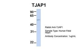 Invitrogen TJAP1 Polyclonal Antibody 100 &mu;L; Unconjugated:Antibodies,