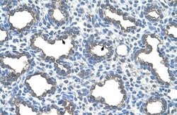 Invitrogen UBE2D2 Polyclonal Antibody 100 &mu;L; Unconjugated:Antibodies,