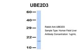 Invitrogen UBE2D3 Polyclonal Antibody 100 &mu;L; Unconjugated:Antibodies,