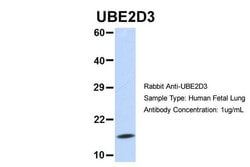 Invitrogen UBE2D3 Polyclonal Antibody 100 &mu;L; Unconjugated:Antibodies,
