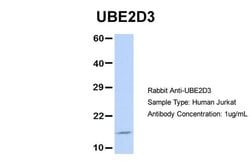 Invitrogen UBE2D3 Polyclonal Antibody 100 &mu;L; Unconjugated:Antibodies,