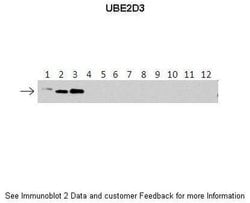 Invitrogen UBE2D3 Polyclonal Antibody 100 &mu;L; Unconjugated:Antibodies,