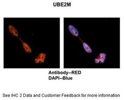 Invitrogen UBE2M Polyclonal Antibody 100 &mu;L; Unconjugated:Antibodies,