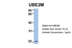 Invitrogen UBE2M Polyclonal Antibody 100 &mu;L; Unconjugated:Antibodies,
