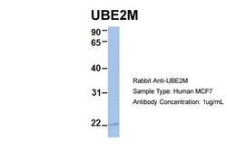 Invitrogen UBE2M Polyclonal Antibody 100 &mu;L; Unconjugated:Antibodies,