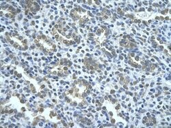 Invitrogen AIP2 Polyclonal Antibody 100 &mu;L; Unconjugated:Antibodies,