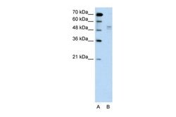 Invitrogen AIP2 Polyclonal Antibody 100 &mu;L; Unconjugated:Antibodies,