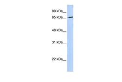 Invitrogen RNF139 Polyclonal Antibody 100 &mu;L; Unconjugated:Antibodies,