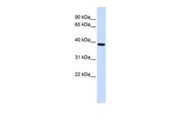 Invitrogen FBXO24 Polyclonal Antibody 100 &mu;L; Unconjugated:Antibodies,