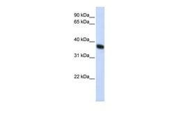 Invitrogen RNF115 Polyclonal Antibody 100 &mu;L; Unconjugated:Antibodies,