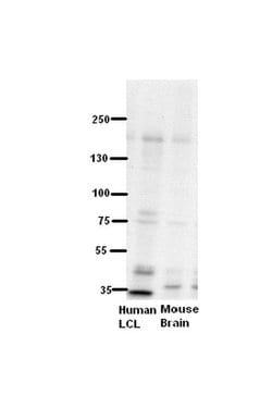 Invitrogen ZNF294 Polyclonal Antibody 100 &mu;L; Unconjugated:Antibodies,