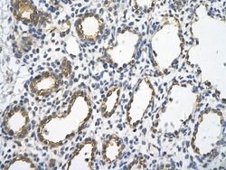 Invitrogen UBE2J1 Polyclonal Antibody 100 &mu;L | Buy Online | Invitrogen&trade; | Fisher Scientific