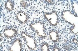Invitrogen UBE2J1 Polyclonal Antibody 100 &mu;L | Buy Online | Invitrogen&trade; | Fisher Scientific
