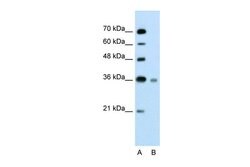 Invitrogen UBE2J1 Polyclonal Antibody 100 &mu;L | Buy Online | Invitrogen&trade; | Fisher Scientific
