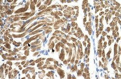 Invitrogen PEX10 Polyclonal Antibody 100 &mu;L; Unconjugated:Antibodies,