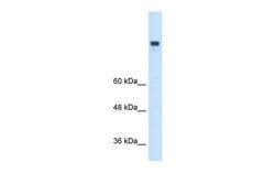 Invitrogen MTTP Polyclonal Antibody 100 &mu;L; Unconjugated:Antibodies,