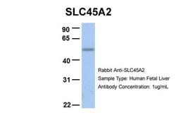 SLC45A2 Polyclonal Antibody, Invitrogen 100 &mu;L; Unconjugated:Antibodies,