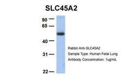 SLC45A2 Polyclonal Antibody, Invitrogen 100 &mu;L; Unconjugated:Antibodies,