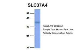 Invitrogen SLC37A4 Polyclonal Antibody 100 &mu;L; Unconjugated:Antibodies,