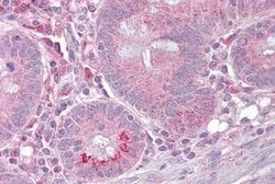 Invitrogen SLC13A2 Polyclonal Antibody 100 &mu;L; Unconjugated:Antibodies,