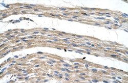 Invitrogen SLC17A4 Polyclonal Antibody 100 &mu;L; Unconjugated:Antibodies,