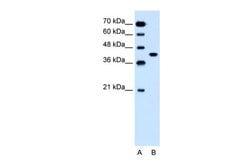 Invitrogen SLC35B1 Polyclonal Antibody 100 &mu;L | Buy Online | Invitrogen&trade; | Fisher Scientific