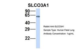 Invitrogen SLCO3A1 Polyclonal Antibody 100 &mu;L; Unconjugated:Antibodies,