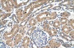 Invitrogen SLC16A8 Polyclonal Antibody 100 &mu;L; Unconjugated:Antibodies,