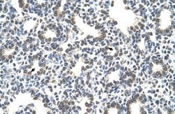 Invitrogen SLC43A3 Polyclonal Antibody 100 &mu;L | Buy Online | Invitrogen&trade; | Fisher Scientific