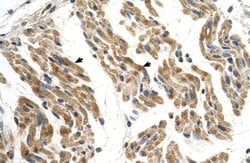 Invitrogen SLC35F2 Polyclonal Antibody 100 &mu;L; Unconjugated:Antibodies,
