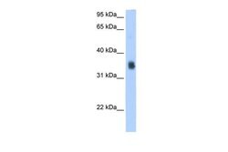 Invitrogen SLC35F2 Polyclonal Antibody 100 &mu;L; Unconjugated:Antibodies,