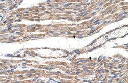 Invitrogen SLC2A6 Polyclonal Antibody 100 &mu;L; Unconjugated:Antibodies,