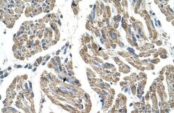 Invitrogen SLC25A38 Polyclonal Antibody 100 &mu;L; Unconjugated:Antibodies,