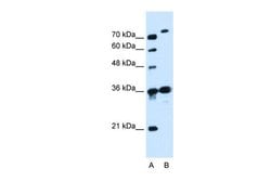 Invitrogen SLC9A7 Polyclonal Antibody 100 &mu;L; Unconjugated:Antibodies,