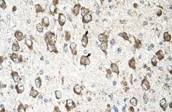 Invitrogen SLC26A8 Polyclonal Antibody 100 &mu;L; Unconjugated:Antibodies,