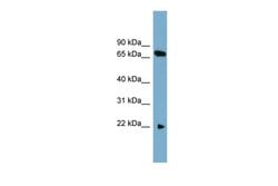 Invitrogen SLC24A4 Polyclonal Antibody 100 &mu;L; Unconjugated:Antibodies,