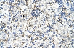 Invitrogen SLC39A5 Polyclonal Antibody 100 &mu;L; Unconjugated:Antibodies,