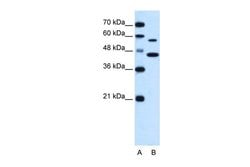Invitrogen SLC39A5 Polyclonal Antibody 100 &mu;L; Unconjugated:Antibodies,