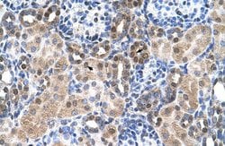 Invitrogen SLC46A3 Polyclonal Antibody 100 &mu;L | Buy Online | Invitrogen&trade; | Fisher Scientific