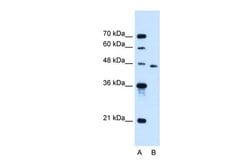 Invitrogen SLC16A12 Polyclonal Antibody 100 &mu;L; Unconjugated:Antibodies,