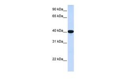 Invitrogen G6PC Polyclonal Antibody 100 &mu;L; Unconjugated:Antibodies,