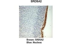 Invitrogen SRD5A2 Polyclonal Antibody 100 &mu;L; Unconjugated:Antibodies,