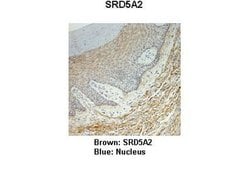Invitrogen SRD5A2 Polyclonal Antibody 100 &mu;L; Unconjugated:Antibodies,