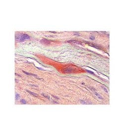 Invitrogen™ M-CSF Polyclonal Antibody