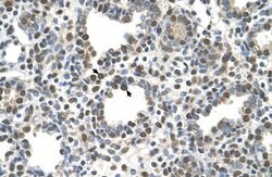 Invitrogen ZDHHC13 Polyclonal Antibody 100 &mu;L; Unconjugated:Antibodies,
